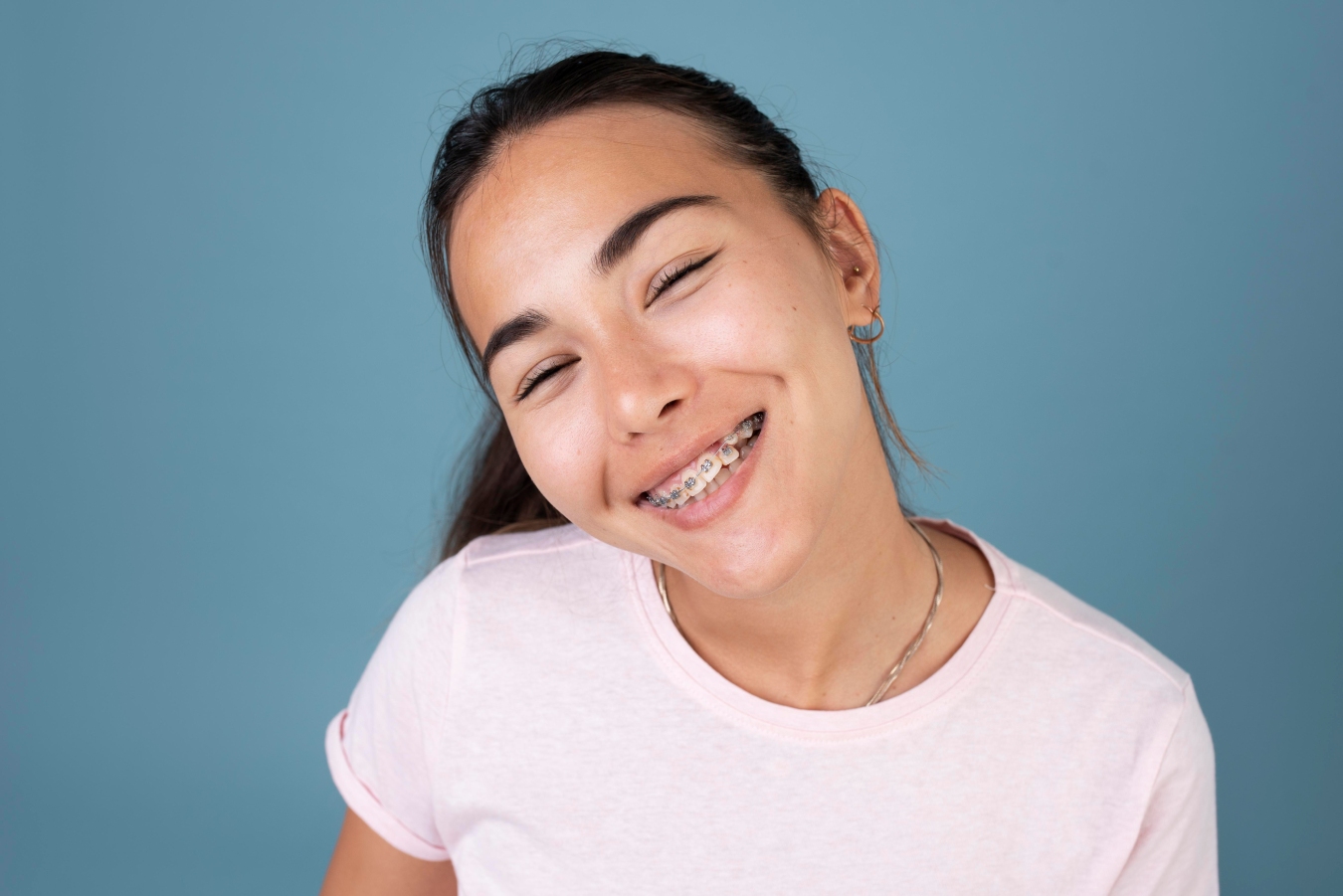 Our Options for Types of Braces