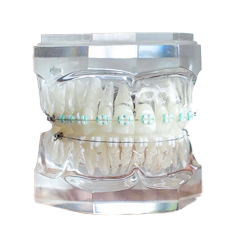 LightForce Customized Braces