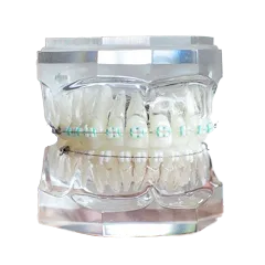 LightForce Customized Braces